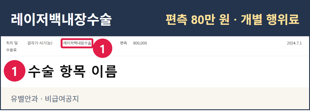 유밸안과 비급여공지의 실제 화면. 레이저백내장수술 행에 편측 80만 원이 고지돼 있다.